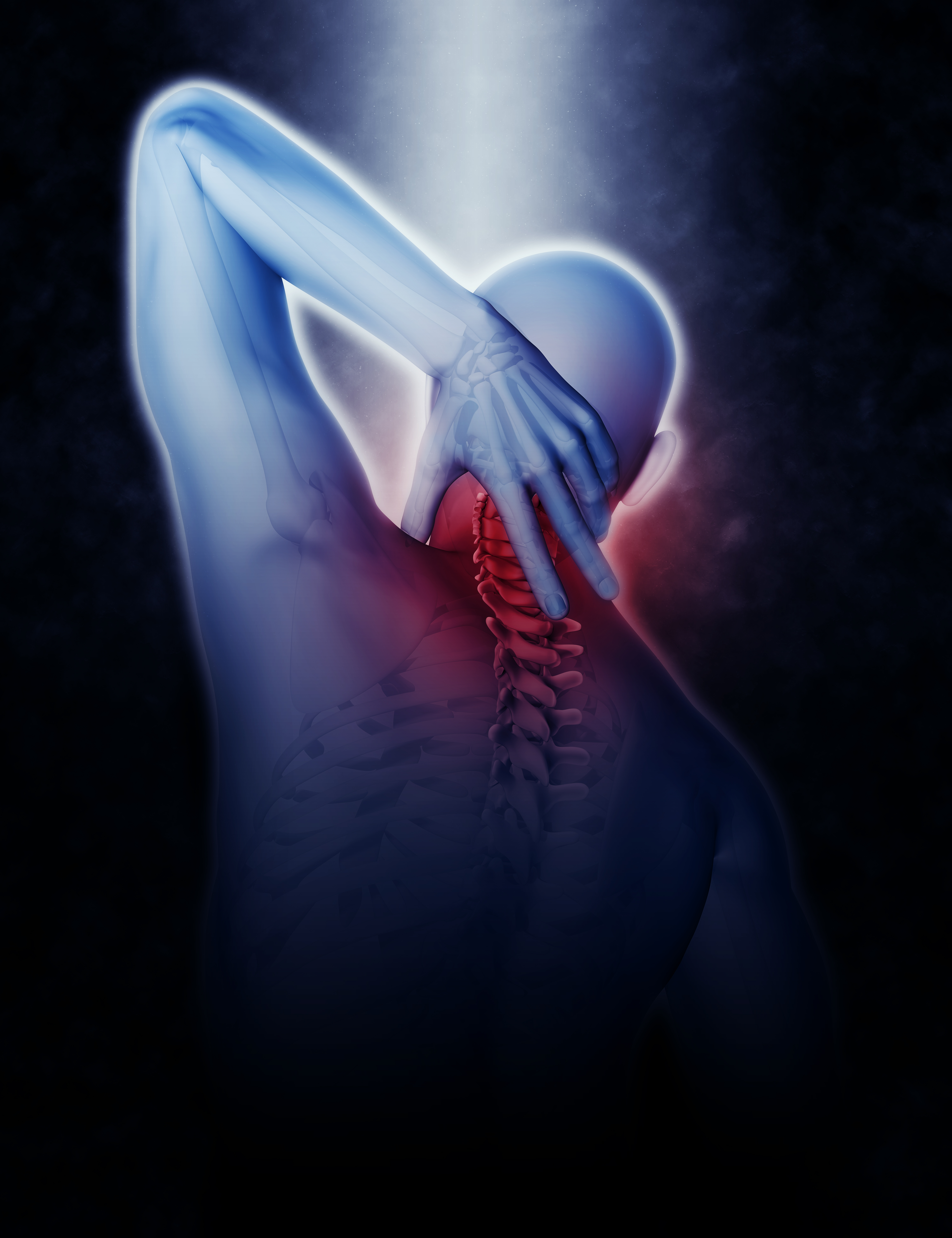 Musculoskeletal Disorders